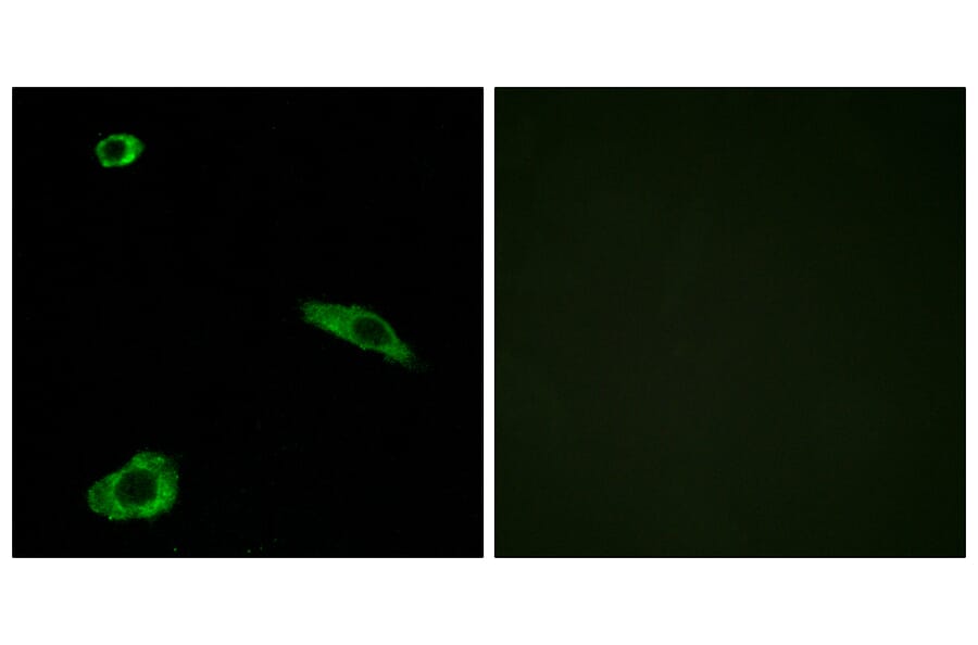 Immunofluorescence - Anti-ACTHR Antibody (G210) - Antibodies.com