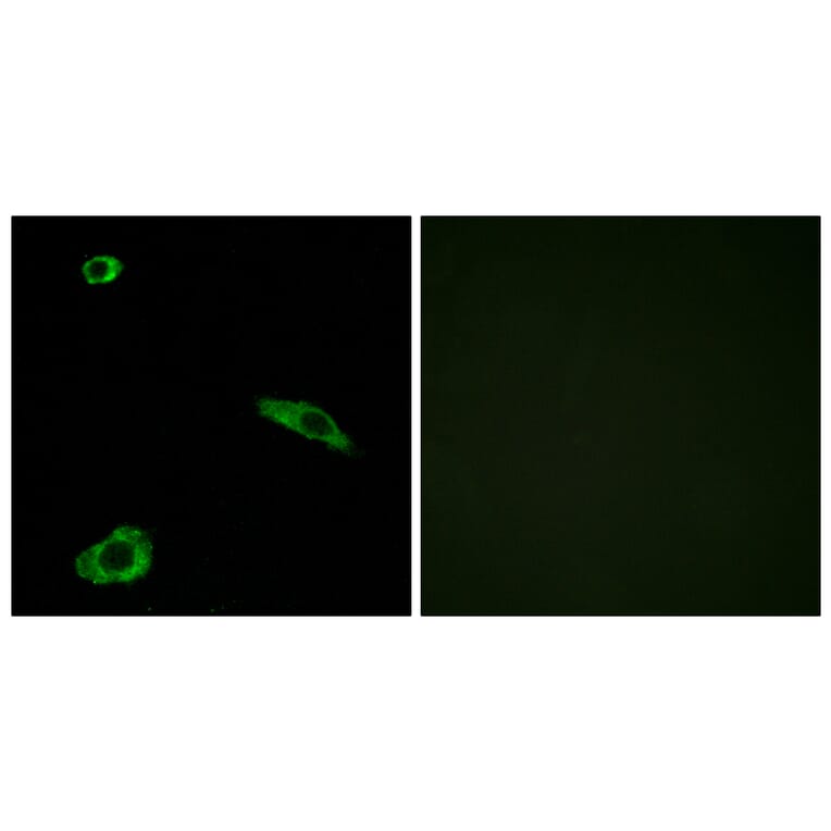 Immunofluorescence - Anti-ACTHR Antibody (G210) - Antibodies.com