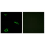 Immunofluorescence - Anti-ACTHR Antibody (G210) - Antibodies.com
