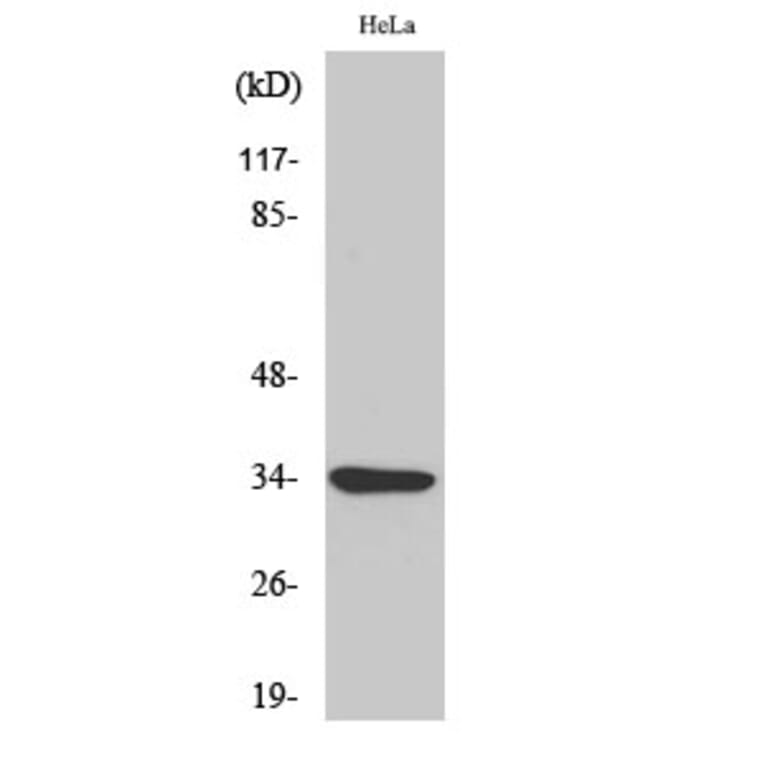 Western Blot - Anti-ACTHR Antibody (G210) - Antibodies.com