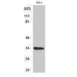 Western Blot - Anti-ACTHR Antibody (G210) - Antibodies.com