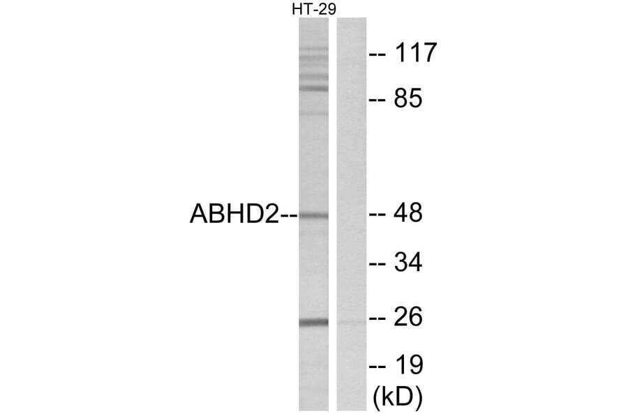 Western Blot - Anti-ABHD2 Antibody (C14214) - Antibodies.com