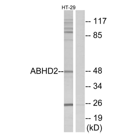 Western Blot - Anti-ABHD2 Antibody (C14214) - Antibodies.com