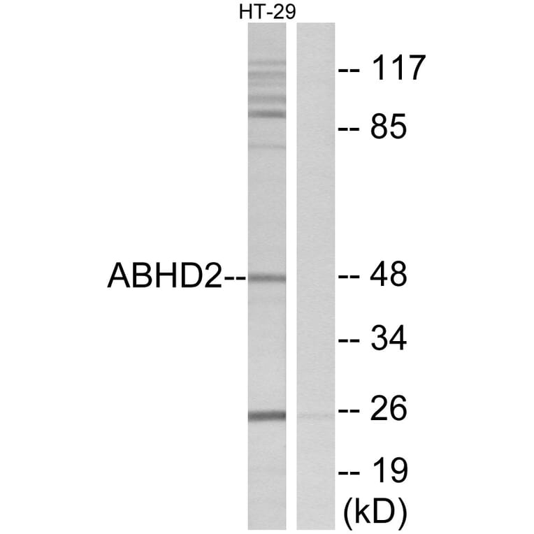 Western Blot - Anti-ABHD2 Antibody (C14214) - Antibodies.com