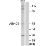 Western Blot - Anti-ABHD2 Antibody (C14214) - Antibodies.com