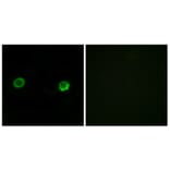 Immunofluorescence - Anti-ABHD2 Antibody (C14214) - Antibodies.com