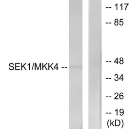 Western Blot - Anti-SEK1 Antibody (B7215) - Antibodies.com
