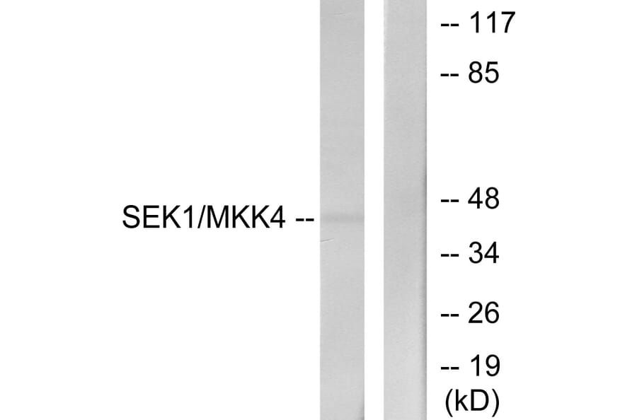 Western Blot - Anti-SEK1 Antibody (B7215) - Antibodies.com