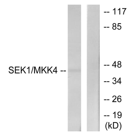 Western Blot - Anti-SEK1 Antibody (B7215) - Antibodies.com