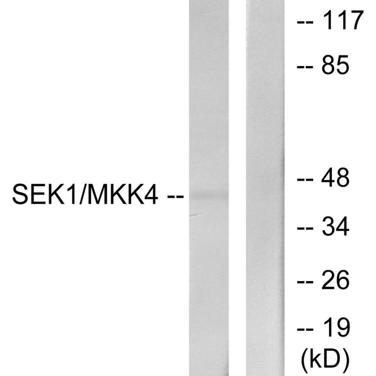 Western Blot - Anti-SEK1 Antibody (B7215) - Antibodies.com