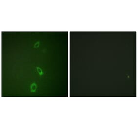 Immunofluorescence - Anti-ROMK Antibody (B1121) - Antibodies.com