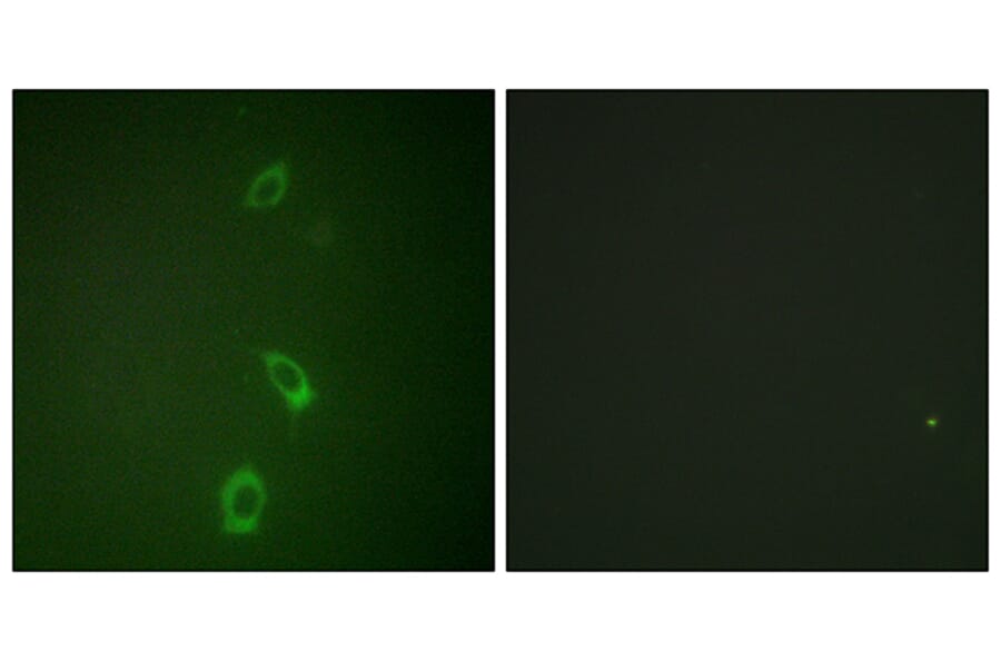 Immunofluorescence - Anti-ROMK Antibody (B1121) - Antibodies.com