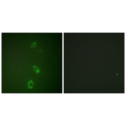 Immunofluorescence - Anti-ROMK Antibody (B1121) - Antibodies.com