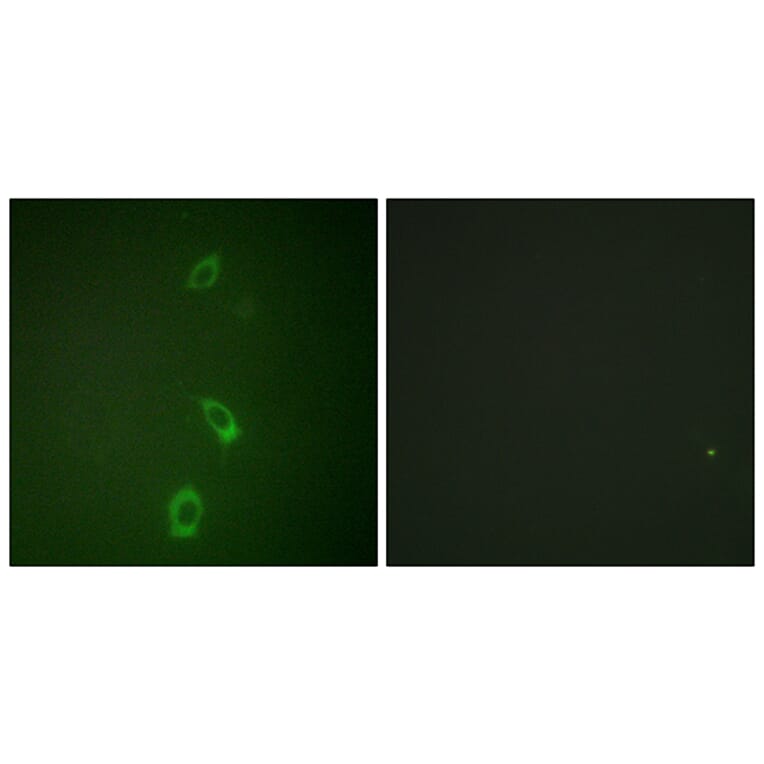 Immunofluorescence - Anti-ROMK Antibody (B1121) - Antibodies.com