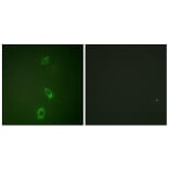 Immunofluorescence - Anti-ROMK Antibody (B1121) - Antibodies.com