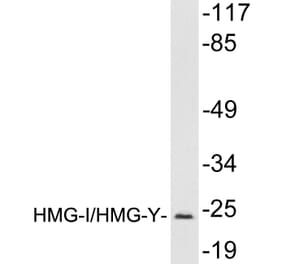 Western Blot - Anti-HMGI Antibody (R12-2184) - Antibodies.com