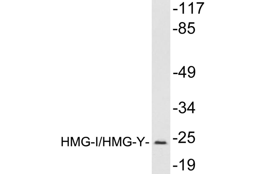 Western Blot - Anti-HMGI Antibody (R12-2184) - Antibodies.com