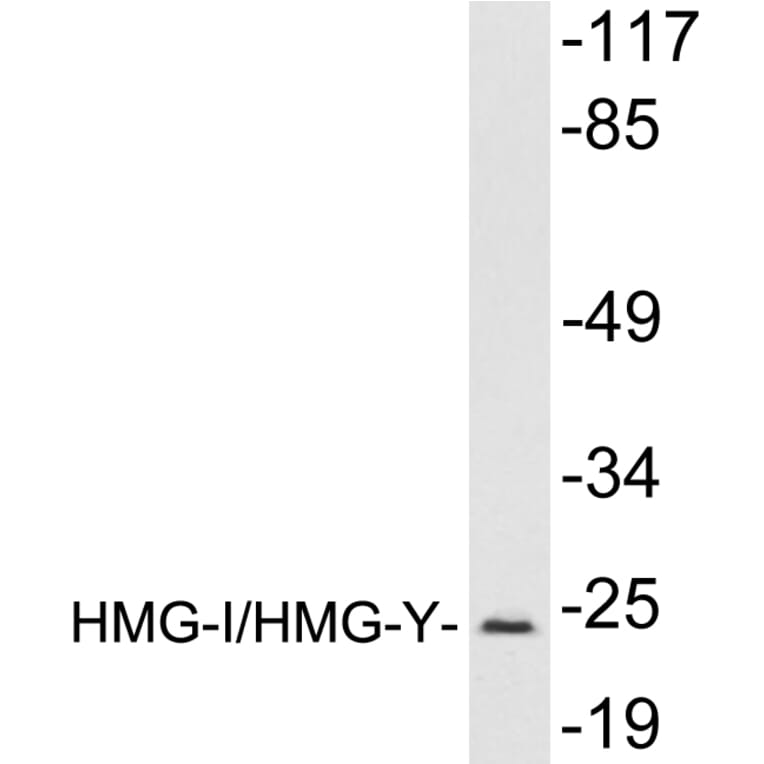 Western Blot - Anti-HMGI Antibody (R12-2184) - Antibodies.com