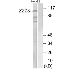 Western Blot - Anti-ZZZ3 Antibody (C19612) - Antibodies.com