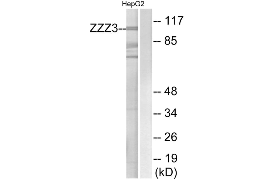 Western Blot - Anti-ZZZ3 Antibody (C19612) - Antibodies.com