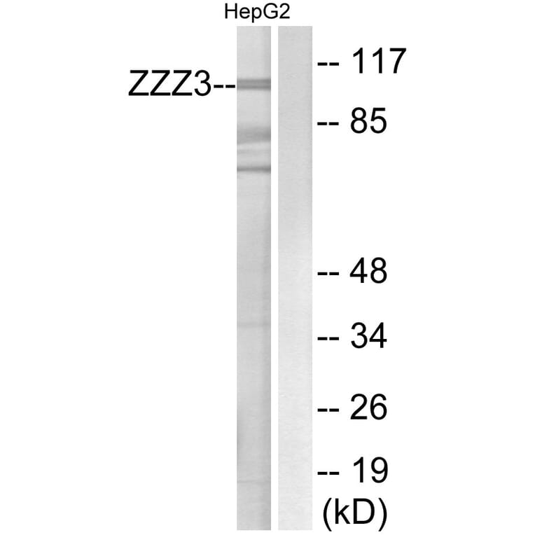 Western Blot - Anti-ZZZ3 Antibody (C19612) - Antibodies.com