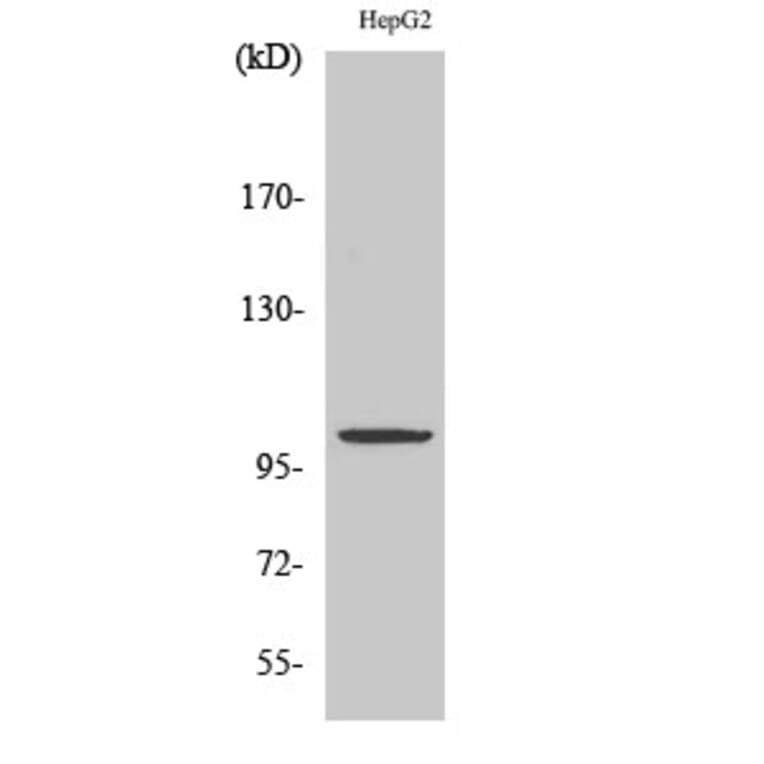 Western Blot - Anti-ZZZ3 Antibody (C19612) - Antibodies.com