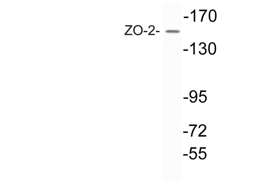 Western Blot - Anti-ZO-2 Antibody (R12-2417) - Antibodies.com