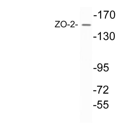 Western Blot - Anti-ZO-2 Antibody (R12-2417) - Antibodies.com