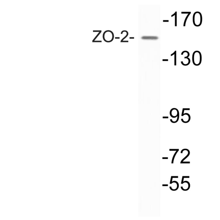 Western Blot - Anti-ZO-2 Antibody (R12-2417) - Antibodies.com