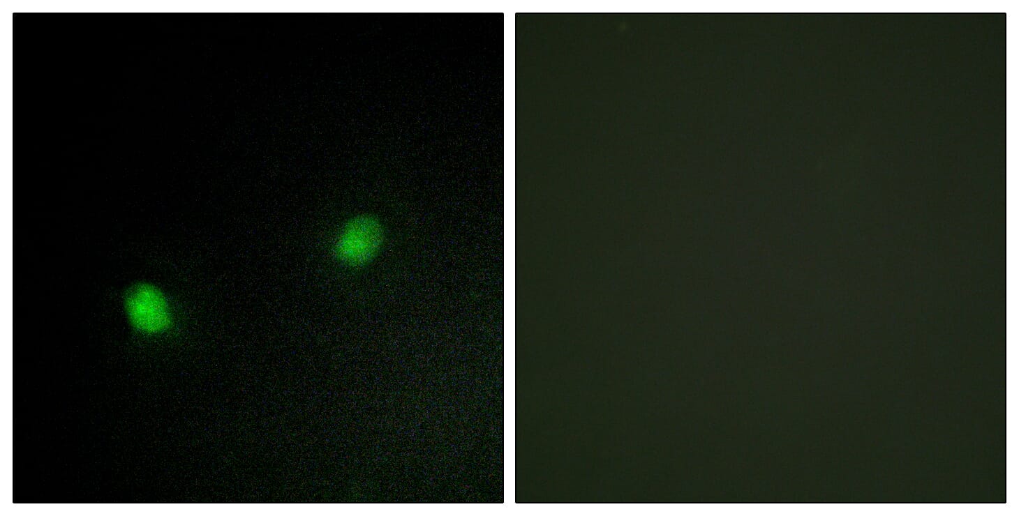 Immunofluorescence analysis of HeLa cells using Anti-ZNF7 Antibody. The right hand panel represents a negative control, where the antibody was pre-incubated with the immunising peptide.
