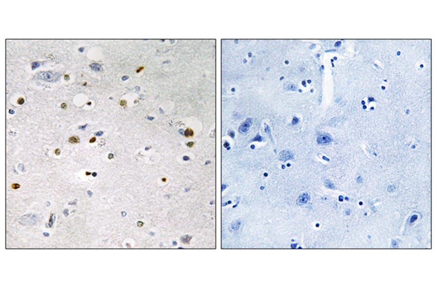 Immunohistochemistry - Anti-ZNF7 Antibody (C10399) - Antibodies.com