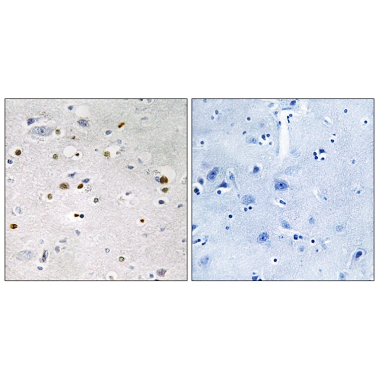 Immunohistochemistry - Anti-ZNF7 Antibody (C10399) - Antibodies.com