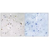 Immunohistochemistry - Anti-ZNF7 Antibody (C10399) - Antibodies.com