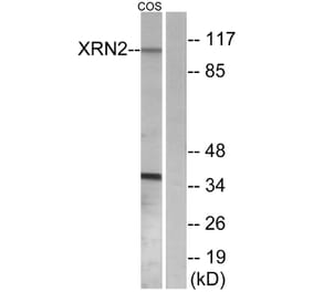 Western Blot - Anti-XRN2 Antibody (C11672) - Antibodies.com