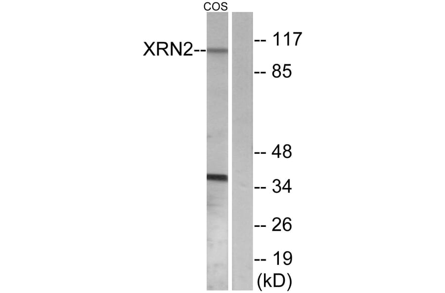 Western Blot - Anti-XRN2 Antibody (C11672) - Antibodies.com