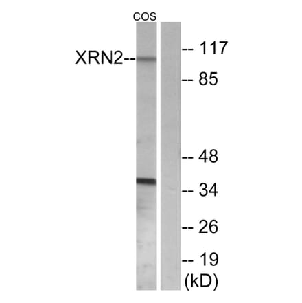 Western Blot - Anti-XRN2 Antibody (C11672) - Antibodies.com