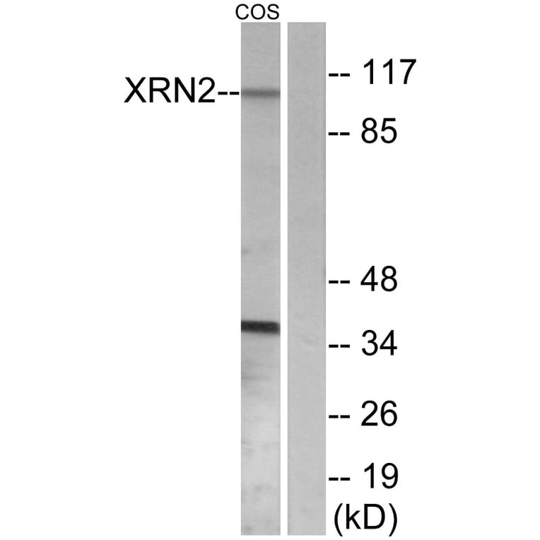 Western Blot - Anti-XRN2 Antibody (C11672) - Antibodies.com