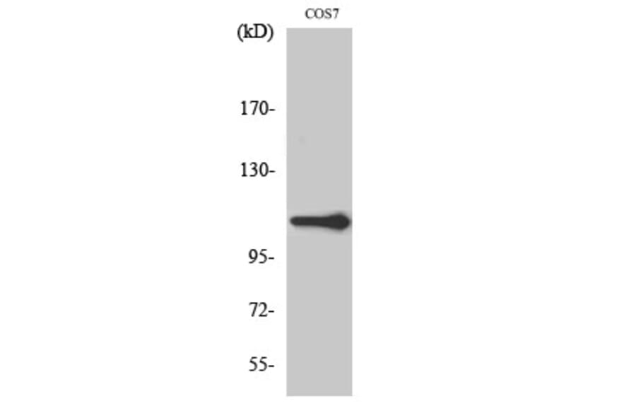 Western Blot - Anti-XRN2 Antibody (C11672) - Antibodies.com