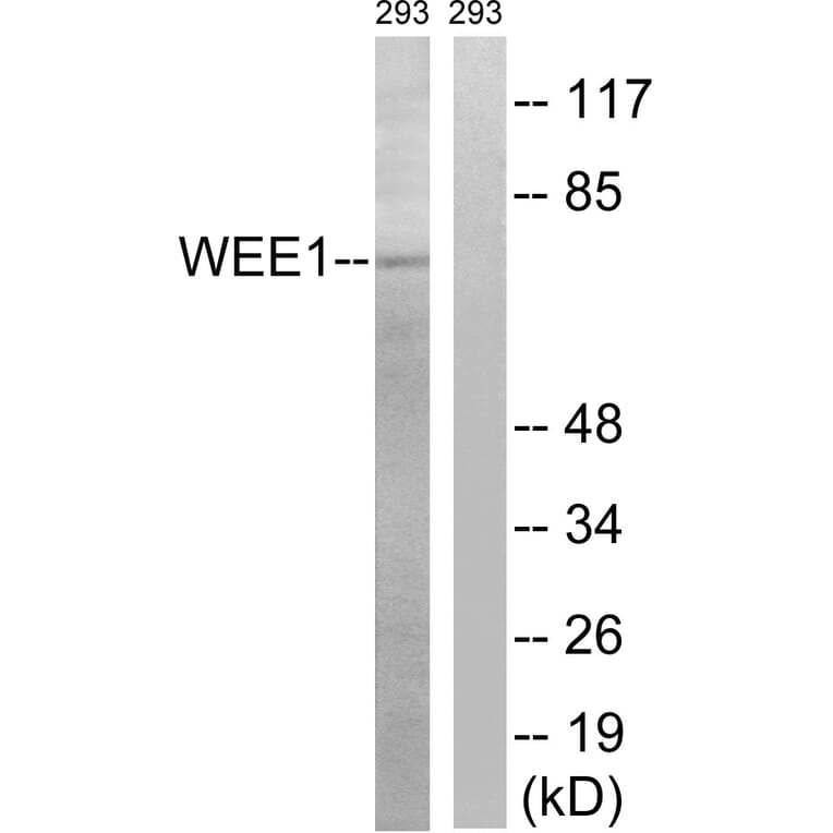 Western Blot - Anti-WEE1 Antibody (B8199) - Antibodies.com