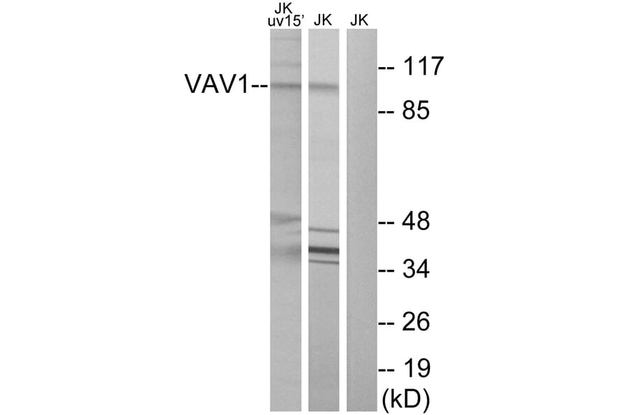 Western Blot - Anti-VAV1 Antibody (B7251) - Antibodies.com