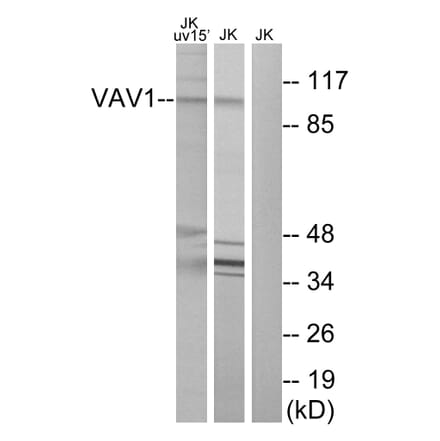 Western Blot - Anti-VAV1 Antibody (B7251) - Antibodies.com
