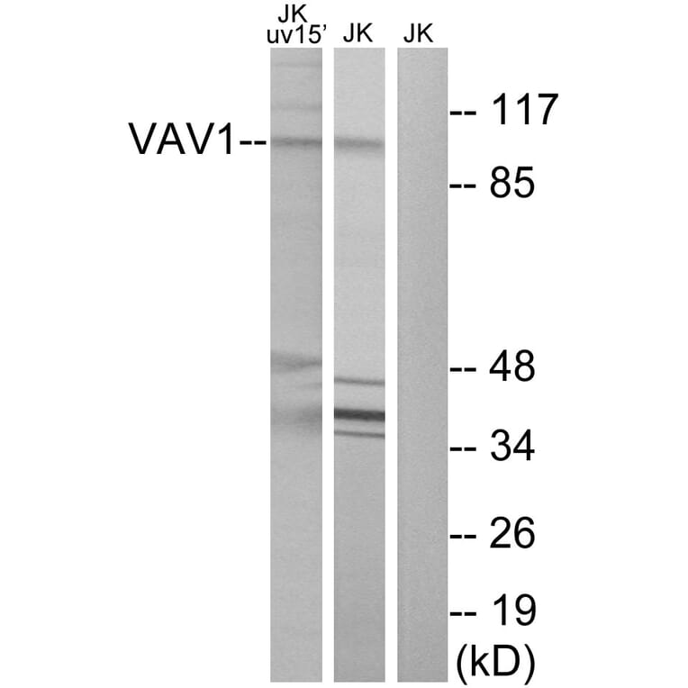 Western Blot - Anti-VAV1 Antibody (B7251) - Antibodies.com