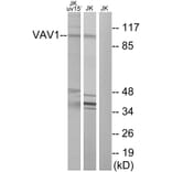 Western Blot - Anti-VAV1 Antibody (B7251) - Antibodies.com