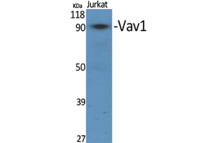 Western Blot - Anti-VAV1 Antibody (B7251) - Antibodies.com