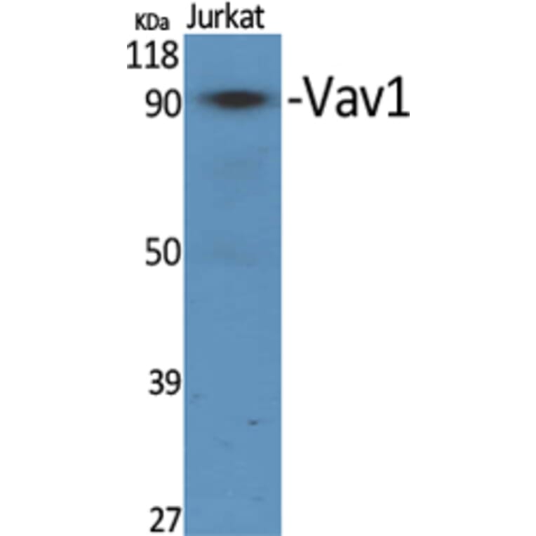 Western Blot - Anti-VAV1 Antibody (B7251) - Antibodies.com