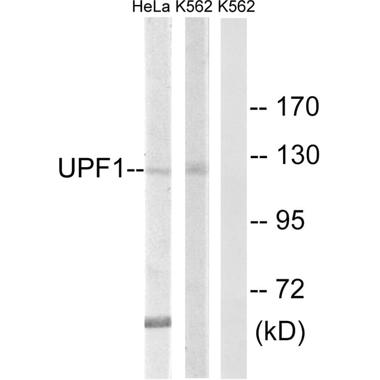 Western Blot - Anti-UPF1 Antibody (C18329) - Antibodies.com