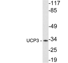 Western Blot - Anti-UCP3 Antibody (R12-2401) - Antibodies.com