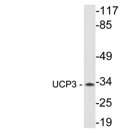 Western Blot - Anti-UCP3 Antibody (R12-2401) - Antibodies.com
