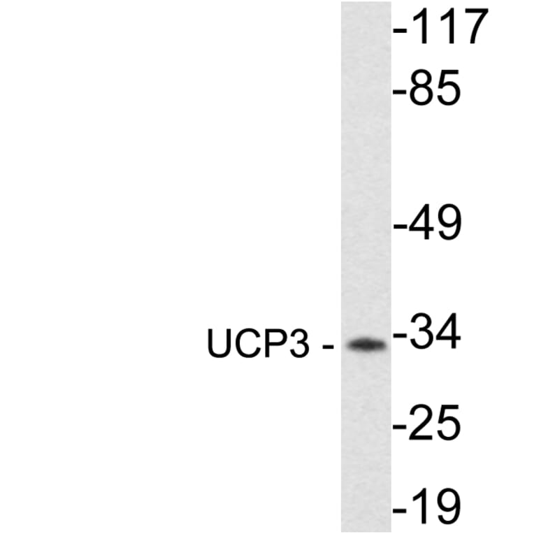 Western Blot - Anti-UCP3 Antibody (R12-2401) - Antibodies.com