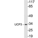 Western Blot - Anti-UCP3 Antibody (R12-2401) - Antibodies.com